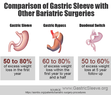 Comparison-of-Gastric-Sleeve-With-Other-Bariatric-Surgeries
